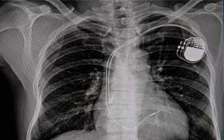 Magnetic Field Safety Guidelines for Pacemakers Magnetic Field Safety Guidelines for Pacemakers